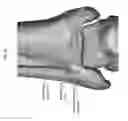 Fig. 69 - Intramedullary fracture fixation devices and methods