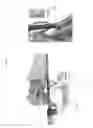 Fig. 79 - Intramedullary fracture fixation devices and methods