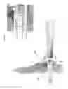 Fig. 81 - Intramedullary fracture fixation devices and methods