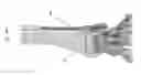 Fig. 86 - Intramedullary fracture fixation devices and methods