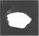 Fig. 01 - Bone plate locking mechanism