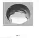 Fig. 08 - Bone plate locking mechanism