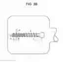 Fig. 06 - Expansion Screw Bone Tamp