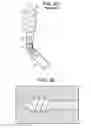 Fig. 12 - Expansion Screw Bone Tamp