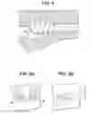 Fig. 13 - Expansion Screw Bone Tamp