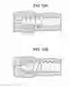 Fig. 16 - Expansion Screw Bone Tamp
