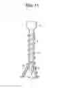 Fig. 17 - Expansion Screw Bone Tamp