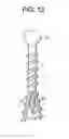 Fig. 19 - Expansion Screw Bone Tamp