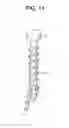 Fig. 20 - Expansion Screw Bone Tamp
