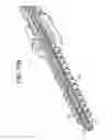Fig. 22 - Expansion Screw Bone Tamp