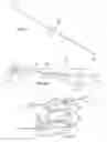 Fig. 06 - Transosseous ribbon wire devices and a system and method for using the devices