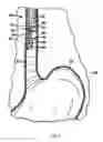Fig. 07 - Cryosurgery system