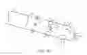 Fig. 15 - Cryosurgery system