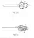 Fig. 19 - Cryosurgery system