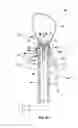 Fig. 06 - Single-handed operable surgical instrument including loop electrode with integrated pad electrode