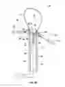 Fig. 07 - Single-handed operable surgical instrument including loop electrode with integrated pad electrode