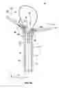 Fig. 08 - Single-handed operable surgical instrument including loop electrode with integrated pad electrode