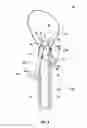 Fig. 09 - Single-handed operable surgical instrument including loop electrode with integrated pad electrode