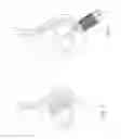 Fig. 09 - Methods and devices to treat nasal airways