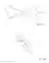Fig. 16 - Methods and devices to treat nasal airways