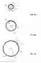 Fig. 06 - Electrical means to normalize ablational energy transmission to a luminal tissue surface of varying size