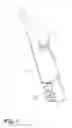 Fig. 04 - Excisional device distal working end actuation mechanism and method