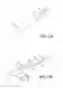 Fig. 16 - Excisional device distal working end actuation mechanism and method