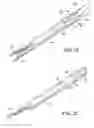 Fig. 22 - Excisional device distal working end actuation mechanism and method