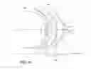 Fig. 24 - Excisional device distal working end actuation mechanism and method