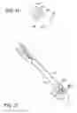 Fig. 34 - Excisional device distal working end actuation mechanism and method