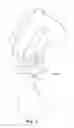 Fig. 07 - Method and a kit of parts for implanting a penile prosthetic insert