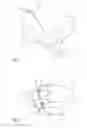 Fig. 06 - Process and device for manufacturing a dental restoration