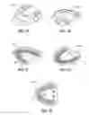 Fig. 08 - Implant analogs having transverse component