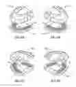 Fig. 10 - Implant analogs having transverse component