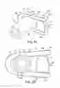 Fig. 03 - Urethra clamp