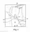 Fig. 06 - Urethra clamp
