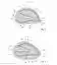 Fig. 03 - Textile-based prosthesis for treatment of inguinal hernia