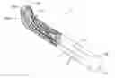 Fig. 01 - Whale concept—folding mesh for TIPP procedure for inguinal hernia