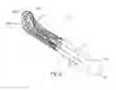 Fig. 05 - Whale concept—folding mesh for TIPP procedure for inguinal hernia