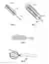 Fig. 02 - CLOT AND FOREIGN BODY RETRIEVAL SYSTEM AND METHOD FOR USE