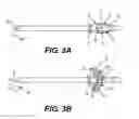 Fig. 03 - TEMPORARY EMBOLIC PROTECTION DEVICE AND METHODS THEREOF
