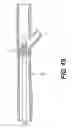 Fig. 12 - TEMPORARY EMBOLIC PROTECTION DEVICE AND METHODS THEREOF