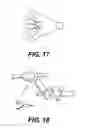 Fig. 14 - TEMPORARY EMBOLIC PROTECTION DEVICE AND METHODS THEREOF