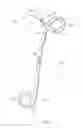Fig. 02 - Ureteral stents with waveform interlayers and interstitching