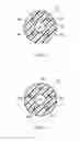 Fig. 10 - Ureteral stents with waveform interlayers and interstitching