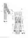 Fig. 05 - Side branch stent graft