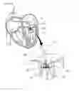 Fig. 06 - Cardiac valve fixing device