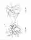 Fig. 05 - Valve prosthesis and method for delivery