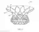Fig. 06 - Valve prosthesis and method for delivery