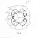 Fig. 09 - Valve prosthesis and method for delivery